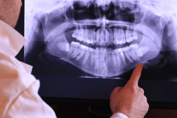 Best Walk-In Emergency Dentist in Parkway, CA