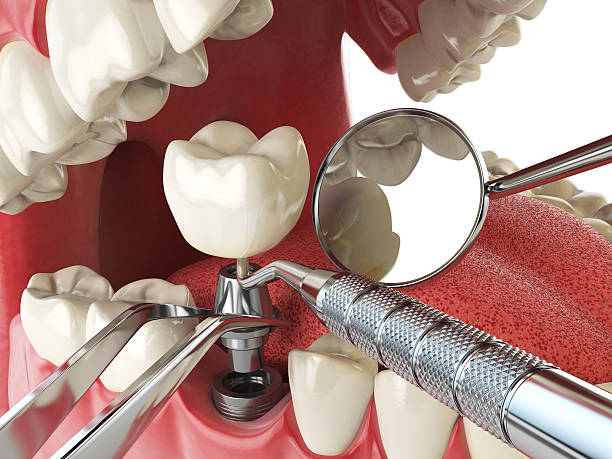 Best Same-Day Emergency Dentist in Parkway, CA